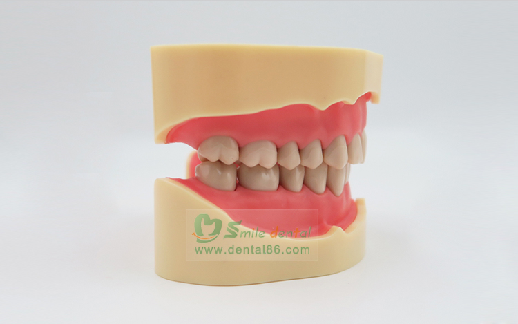 TM-A5-01 Standard Model, BF Style